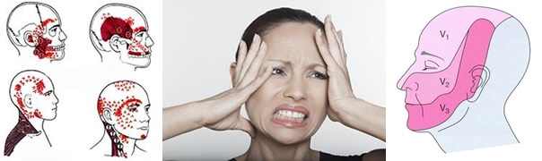 Errores en el diagnóstico de los dolores oro-faciales